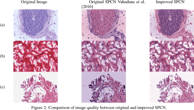 Figure 2 for Fast GPU-Enabled Color Normalization for Digital Pathology