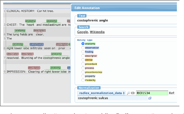 Figure 2 for RadLex Normalization in Radiology Reports