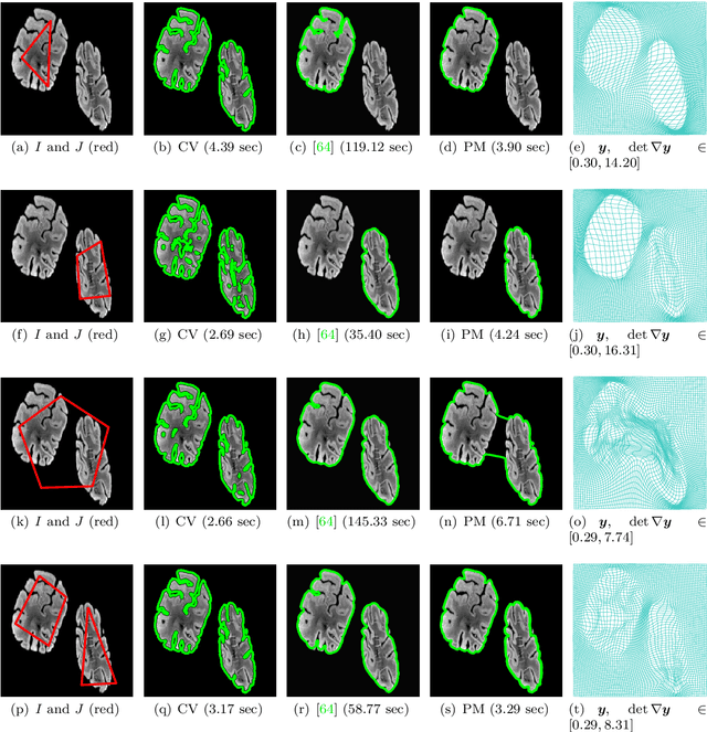 Figure 2 for Topology-Preserving 3D Image Segmentation Based On Hyperelastic Regularization