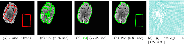 Figure 4 for Topology-Preserving 3D Image Segmentation Based On Hyperelastic Regularization