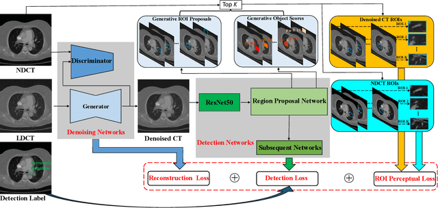 Figure 1 for Lesion-Inspired Denoising Network: Connecting Medical Image Denoising and Lesion Detection