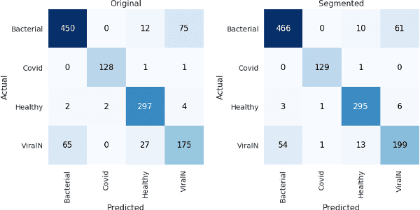 Figure 3 for CXR-Net: An Encoder-Decoder-Encoder Multitask Deep Neural Network for Explainable and Accurate Diagnosis of COVID-19 pneumonia with Chest X-ray Images