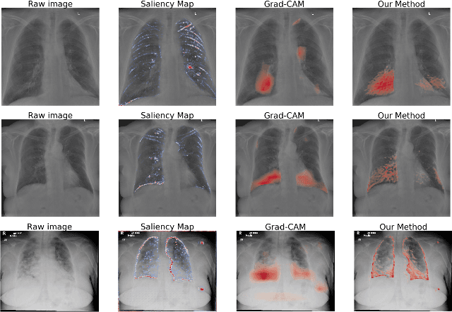 Figure 4 for CXR-Net: An Encoder-Decoder-Encoder Multitask Deep Neural Network for Explainable and Accurate Diagnosis of COVID-19 pneumonia with Chest X-ray Images