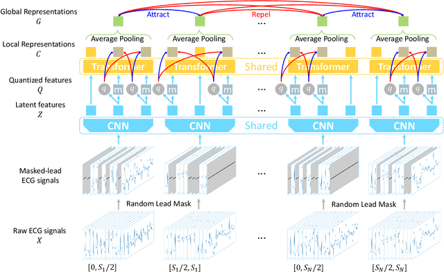 Figure 1 for Lead-agnostic Self-supervised Learning for Local and Global Representations of Electrocardiogram