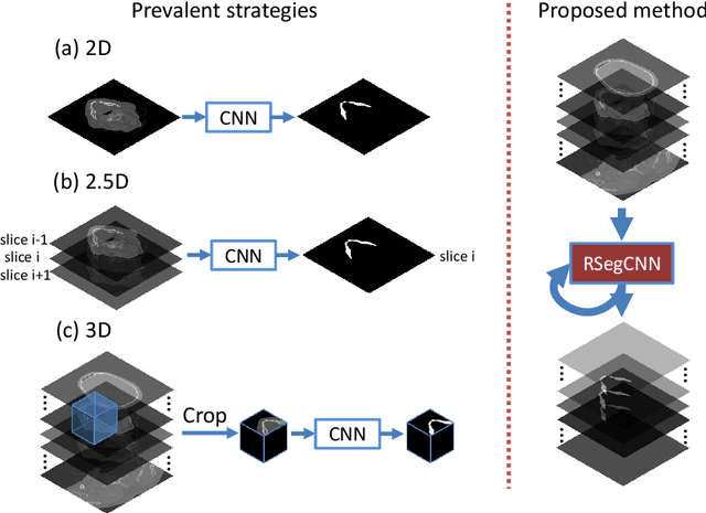 Figure 3 for Recurrent convolutional neural networks for mandible segmentation from computed tomography
