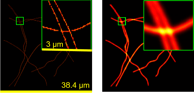 Figure 1 for Deep Unrolled Recovery in Sparse Biological Imaging