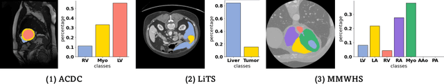 Figure 1 for Mine yOur owN Anatomy: Revisiting Medical Image Segmentation with Extremely Limited Labels