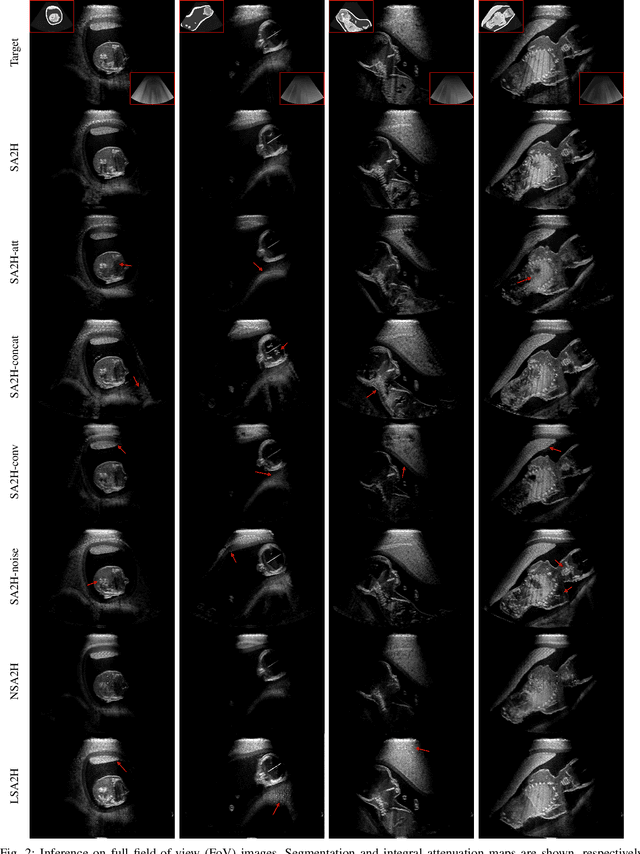 Figure 2 for Learning Ultrasound Rendering from Cross-Sectional Model Slices for Simulated Training