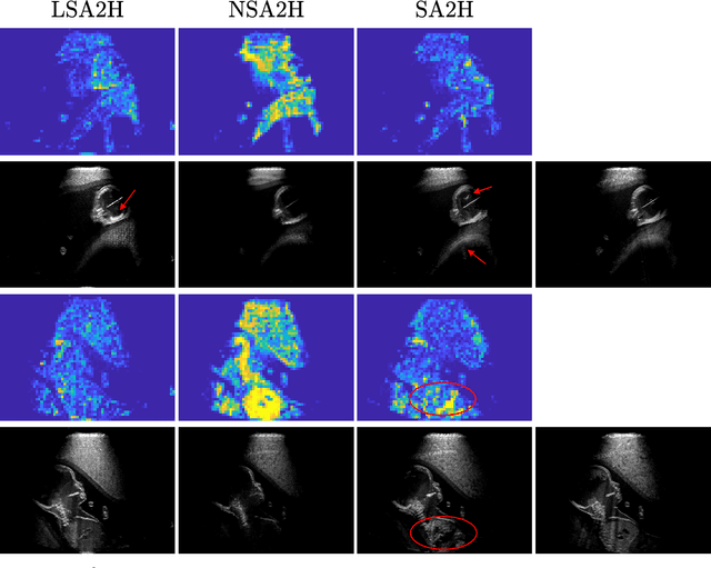 Figure 3 for Learning Ultrasound Rendering from Cross-Sectional Model Slices for Simulated Training