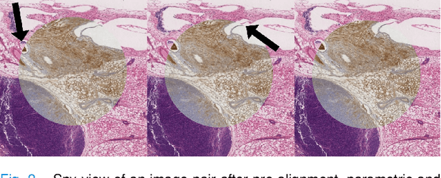 Figure 2 for High-resolution Image Registration of Consecutive and Re-stained Sections in Histopathology