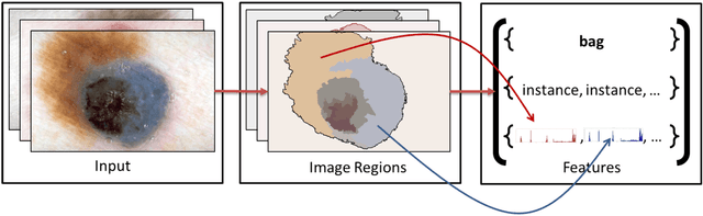 Figure 1 for Learning to Detect Blue-white Structures in Dermoscopy Images with Weak Supervision