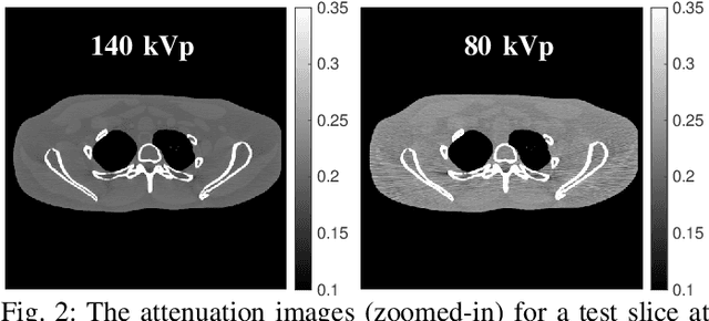Figure 2 for An Improved Iterative Neural Network for High-Quality Image-Domain Material Decomposition in Dual-Energy CT
