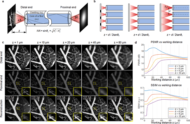 Figure 2 for Learned end-to-end high-resolution lensless fiber imaging toward intraoperative real-time cancer diagnosis