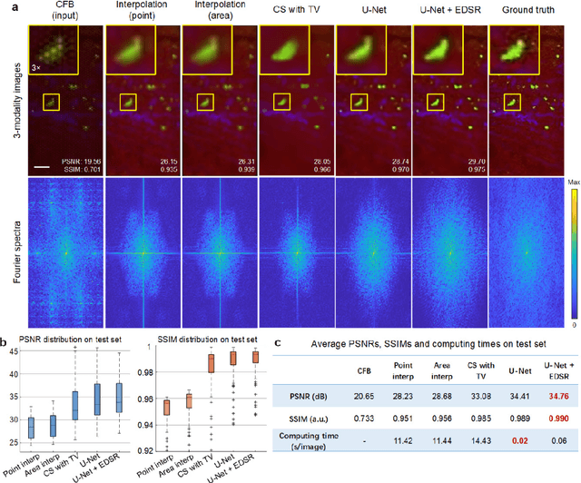 Figure 3 for Learned end-to-end high-resolution lensless fiber imaging toward intraoperative real-time cancer diagnosis