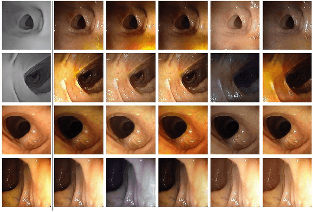 Figure 4 for CLTS-GAN: Color-Lighting-Texture-Specular Reflection Augmentation for Colonoscopy