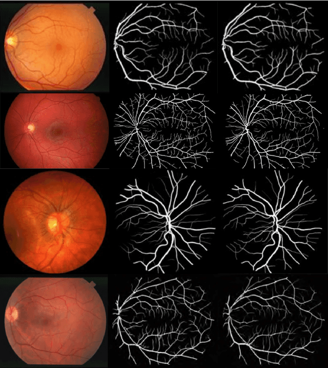 Figure 4 for (M)SLAe-Net: Multi-Scale Multi-Level Attention embedded Network for Retinal Vessel Segmentation