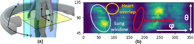 Figure 2 for Learning to Avoid Poor Images: Towards Task-aware C-arm Cone-beam CT Trajectories