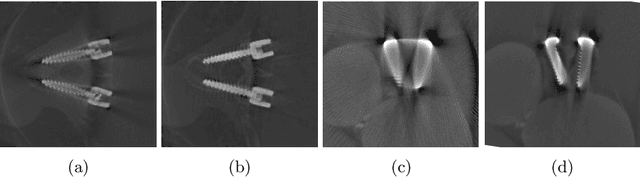 Figure 4 for Learning to Avoid Poor Images: Towards Task-aware C-arm Cone-beam CT Trajectories