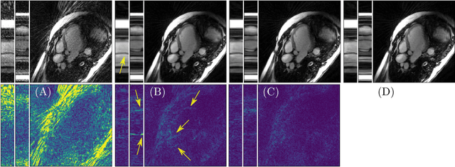 Figure 4 for An End-To-End-Trainable Iterative Network Architecture for Accelerated Radial Multi-Coil 2D Cine MR Image Reconstruction