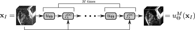 Figure 1 for An End-To-End-Trainable Iterative Network Architecture for Accelerated Radial Multi-Coil 2D Cine MR Image Reconstruction