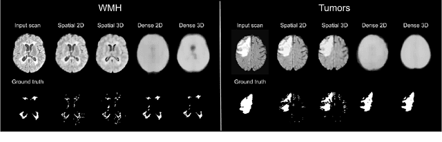 Figure 1 for Leveraging 3D Information in Unsupervised Brain MRI Segmentation