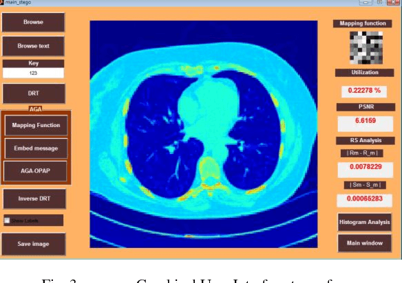 Figure 3 for An Evolutionary Computing Enriched RS Attack Resilient Medical Image Steganography Model for Telemedicine Applications