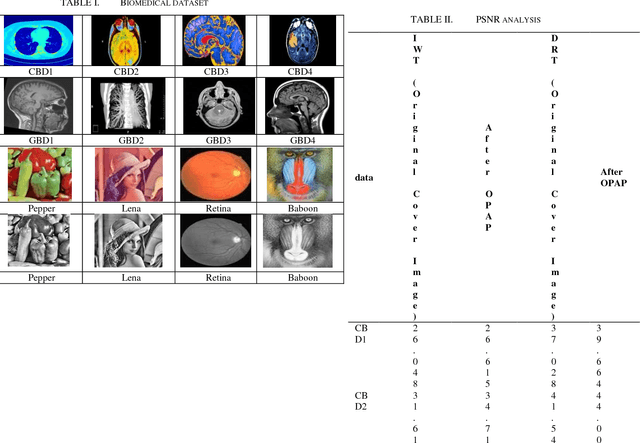 Figure 4 for An Evolutionary Computing Enriched RS Attack Resilient Medical Image Steganography Model for Telemedicine Applications