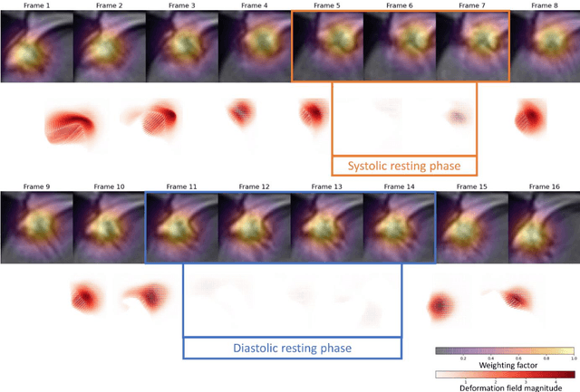 Figure 3 for Automated Cardiac Resting Phase Detection Targeted on the Right Coronary Artery