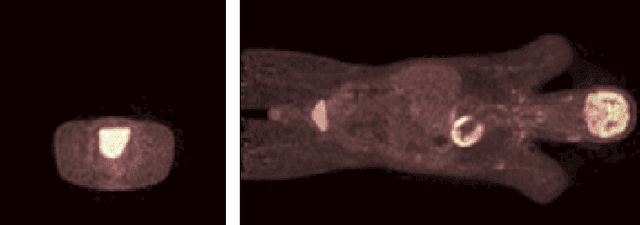 Figure 1 for Blind Deconvolution of PET Images using Anatomical Priors