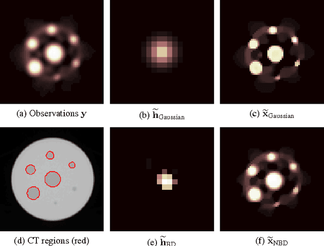 Figure 3 for Blind Deconvolution of PET Images using Anatomical Priors
