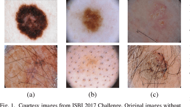 Figure 1 for Multi-class Semantic Segmentation of Skin Lesions via Fully Convolutional Networks