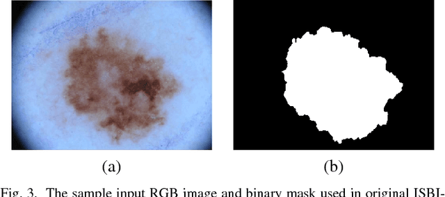Figure 3 for Multi-class Semantic Segmentation of Skin Lesions via Fully Convolutional Networks