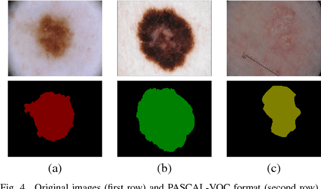 Figure 4 for Multi-class Semantic Segmentation of Skin Lesions via Fully Convolutional Networks