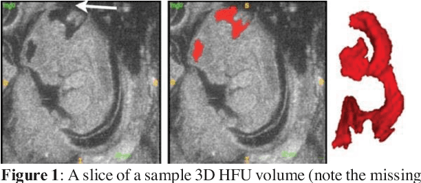 Figure 1 for Deep BV: A Fully Automated System for Brain Ventricle Localization and Segmentation in 3D Ultrasound Images of Embryonic Mice