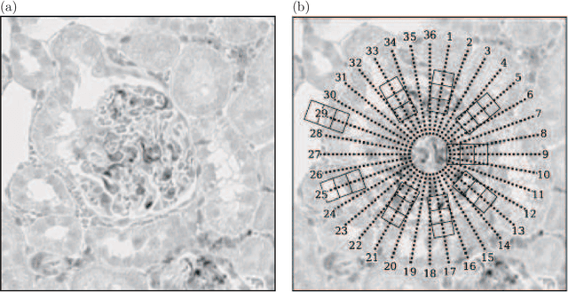 Figure 2 for New Descriptor for Glomerulus Detection in Kidney Microscopy Image