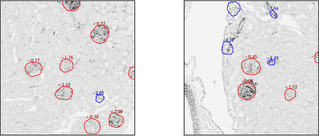 Figure 4 for New Descriptor for Glomerulus Detection in Kidney Microscopy Image