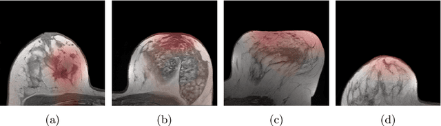 Figure 4 for Multi Scale Curriculum CNN for Context-Aware Breast MRI Malignancy Classification
