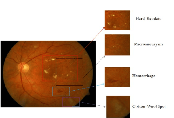 Figure 1 for Classification of Large-Scale Fundus Image Data Sets: A Cloud-Computing Framework