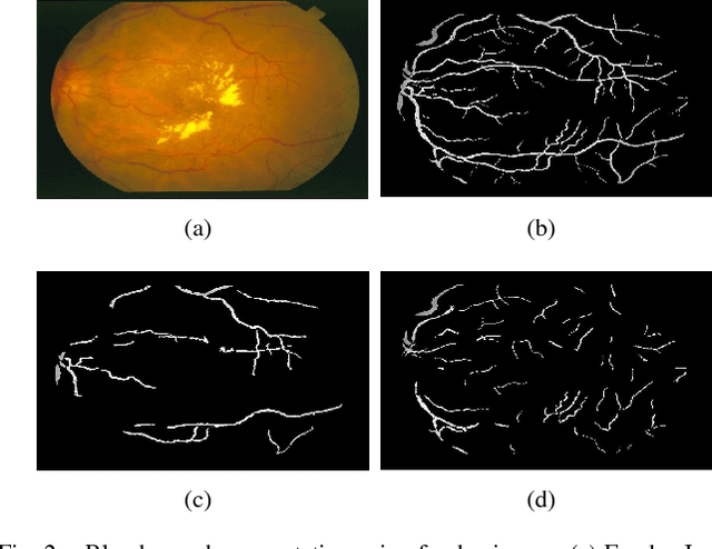 Figure 2 for Classification of Large-Scale Fundus Image Data Sets: A Cloud-Computing Framework
