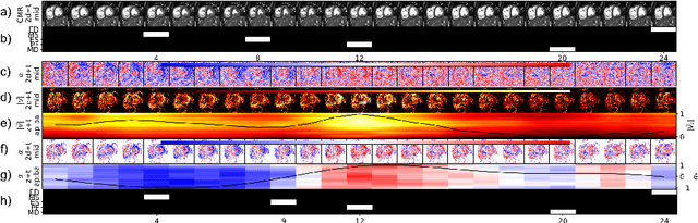 Figure 4 for Self-supervised motion descriptor for cardiac phase detection in 4D CMR based on discrete vector field estimations