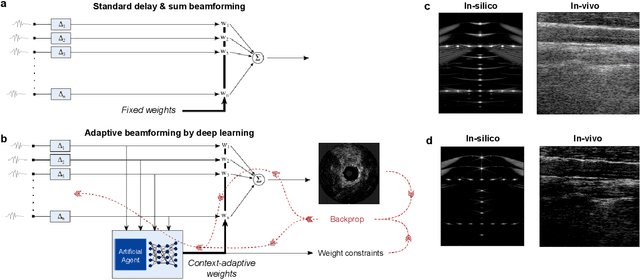 Figure 2 for Deep learning in ultrasound imaging