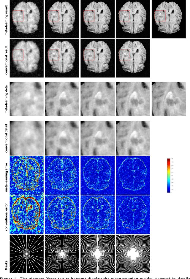 Figure 2 for An Optimization-Based Meta-Learning Model for MRI Reconstruction with Diverse Dataset