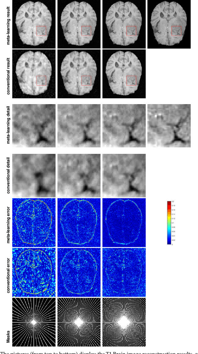 Figure 4 for An Optimization-Based Meta-Learning Model for MRI Reconstruction with Diverse Dataset