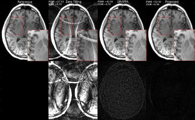 Figure 3 for Deep Plug-and-Play Prior for Parallel MRI Reconstruction