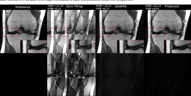 Figure 4 for Deep Plug-and-Play Prior for Parallel MRI Reconstruction