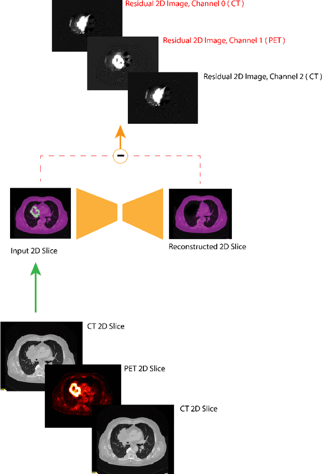 Figure 1 for PriorNet: lesion segmentation in PET-CT including prior tumor appearance information