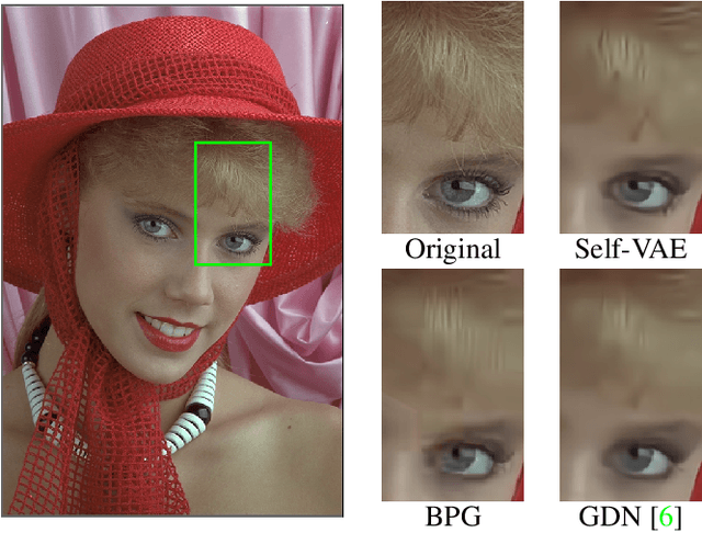 Figure 1 for Self-Organized Variational Autoencoders (Self-VAE) for Learned Image Compression