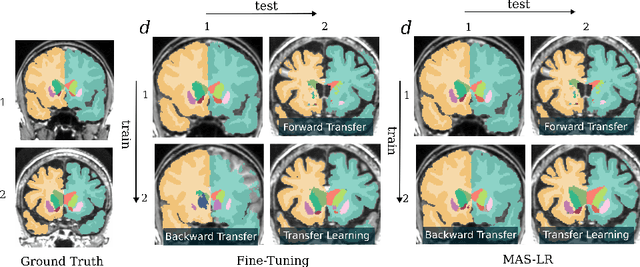 Figure 4 for Importance Driven Continual Learning for Segmentation Across Domains