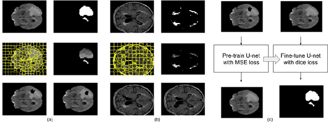 Figure 1 for Region-of-interest guided Supervoxel Inpainting for Self-supervision