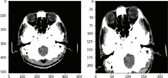 Figure 2 for Convolutional-LSTM for Multi-Image to Single Output Medical Prediction